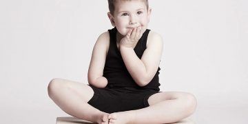 Models with Limb difference in body confidence shoot 5ccbfcefb1581