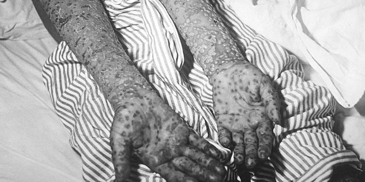 Bildschirmfoto 2020 04 02 um 13.03.52