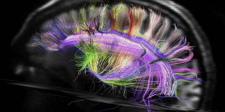 Brain wiring vanweeden