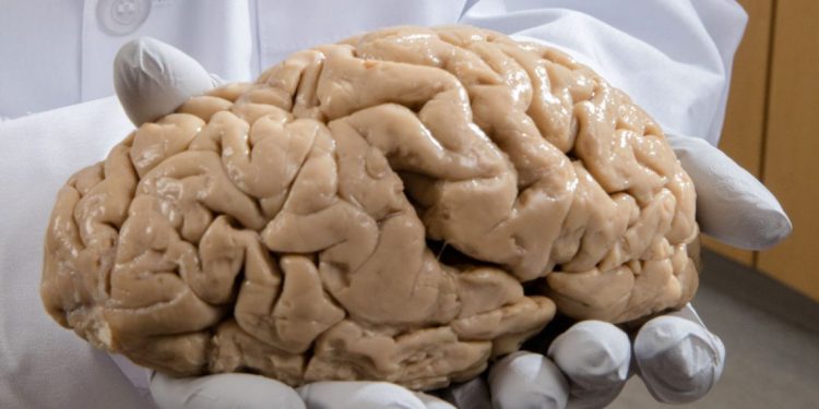 Ca 1214NID Brain Bank online 1140x570